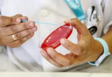 La sífilis acecha: en 2025 se notificaron 46.799 casos en el país